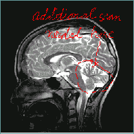 brain_image